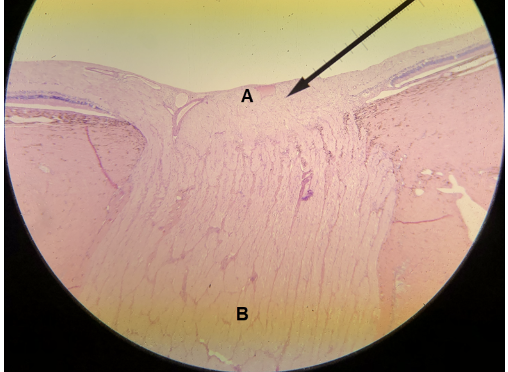 <p>In the image above, identify structures A and B.&nbsp;</p>