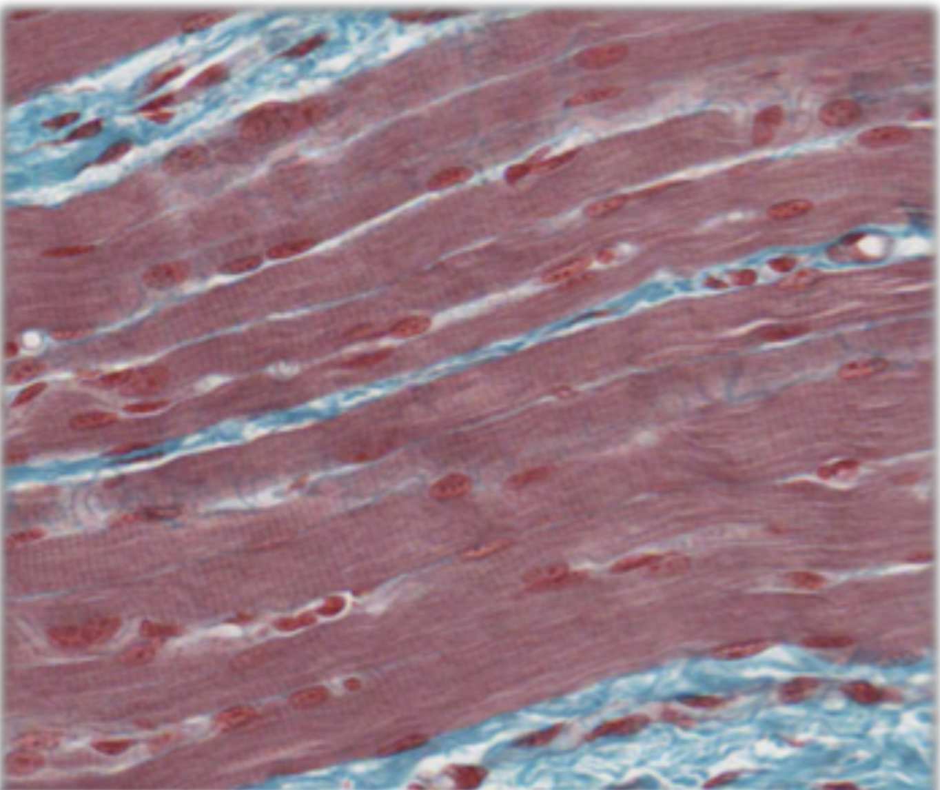 <p>voluntary, striated, multiple peripheral nuclei, long cylindrical fibres, no intercalated discs, attached to bones, limited regeneration, rapid forceful contractions, fatigue possible</p>