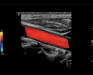 <p>Is this image showing flow towards or away from the transducer? </p>