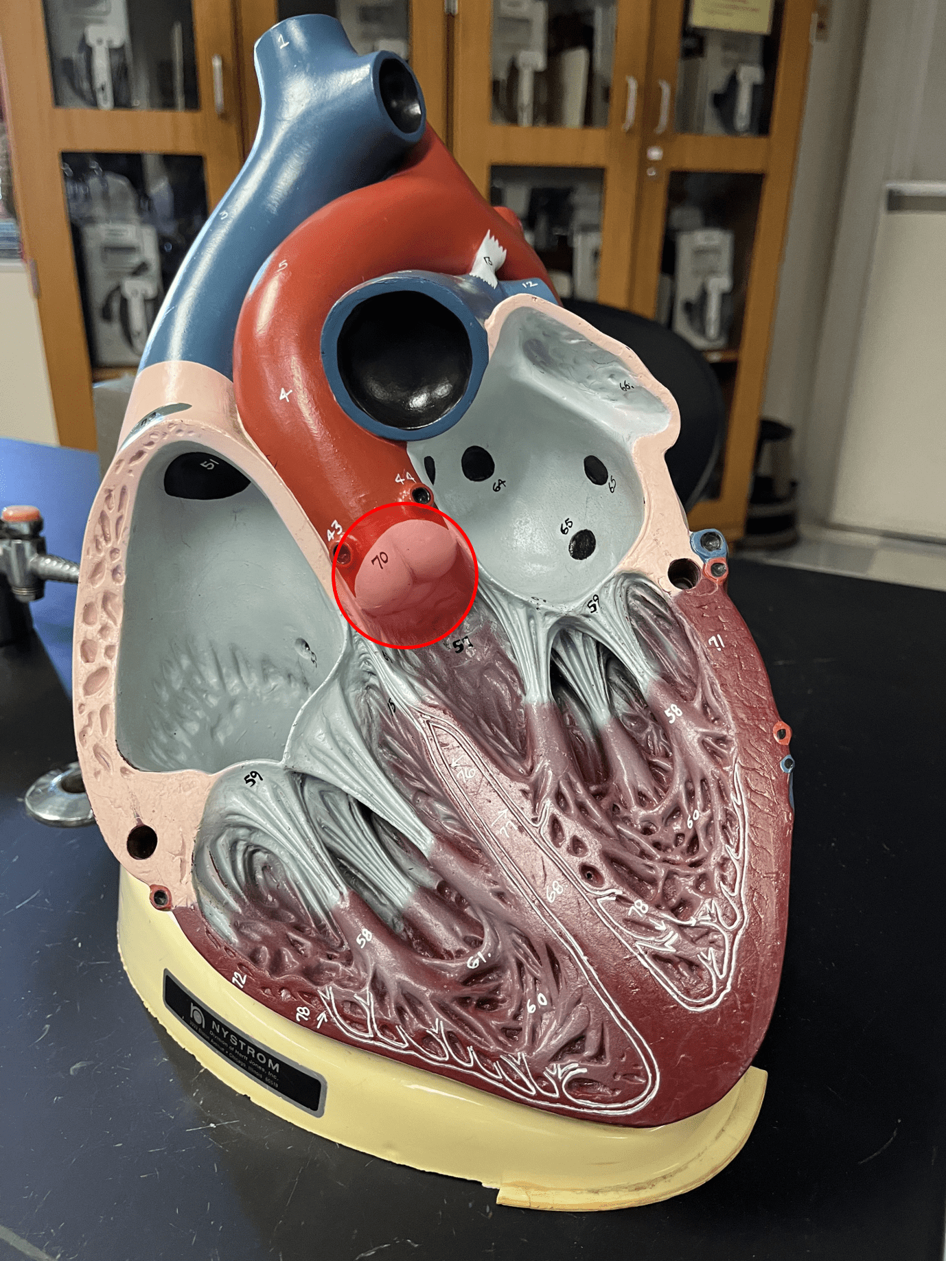 • A semilunar valve.

• Controls the flow of blood from the left ventricle to the ascending aorta.

• Also known as the left semilunar (SL) valve.