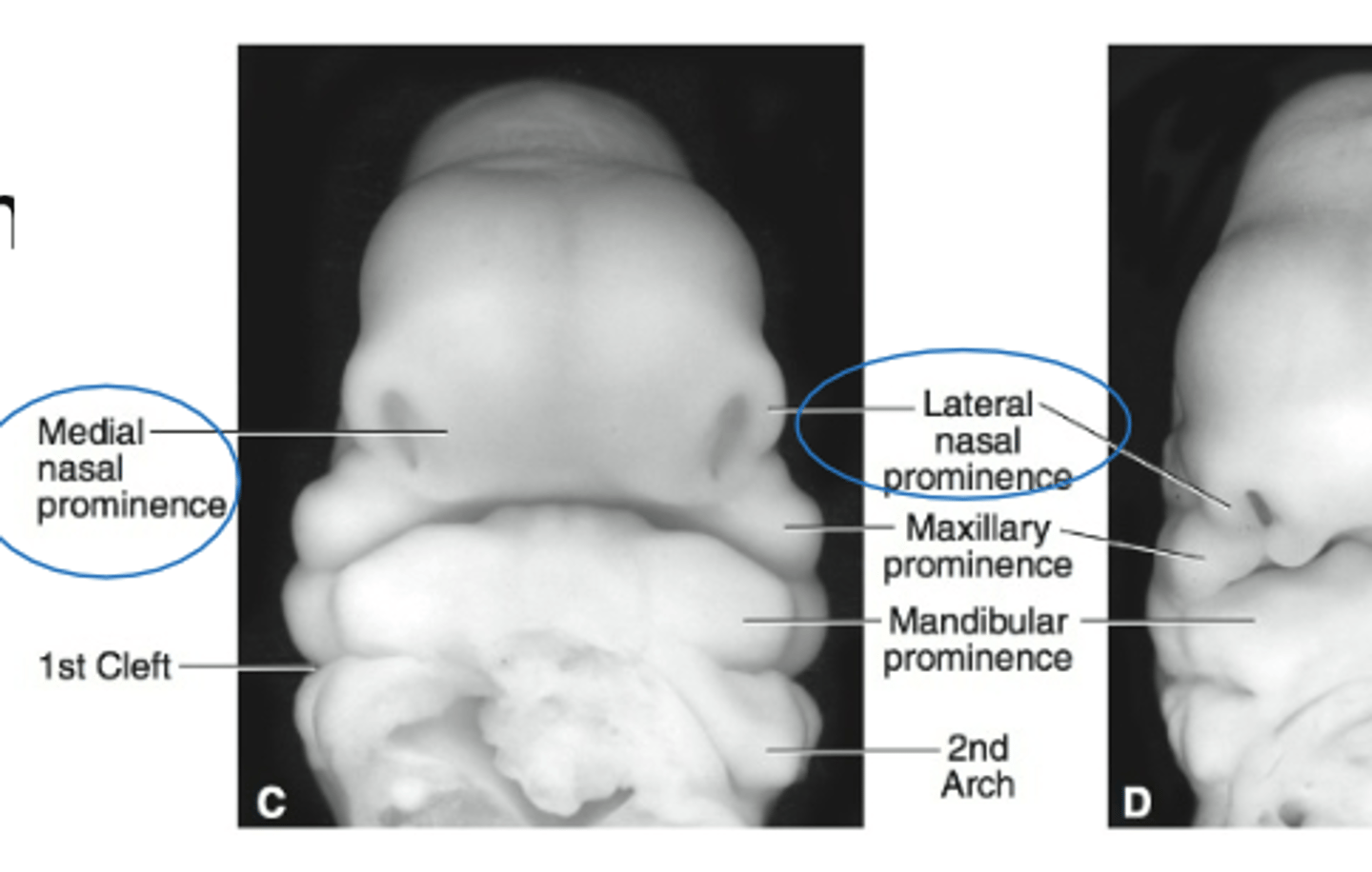 <p>Proliferation of ectomesenchyme of the central face appear in the (2)</p>