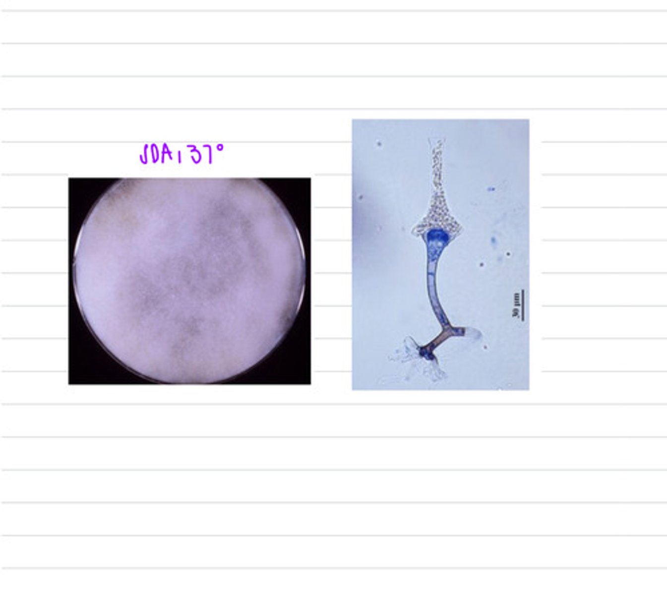 <p>a pig is showing GI signs, including hemorrhage, diarrhea, and abdominal pain. we do an examination and notice enteritis and severe GI ulcers. we take samples from the GI organs and isolate at 37 degrees on SDA.</p><p>what is the diagnosis?</p>