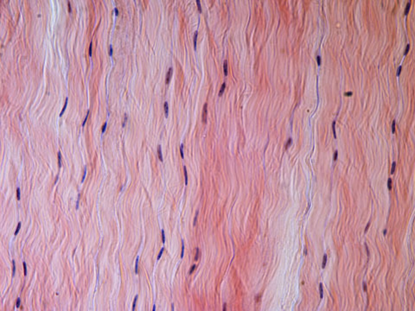 <p>Tissue that looks like tightly packed, parallel bundles of collagen fibers running in the same direction, creating a smooth, wavy pattern well-suited for strength in one direction.</p>