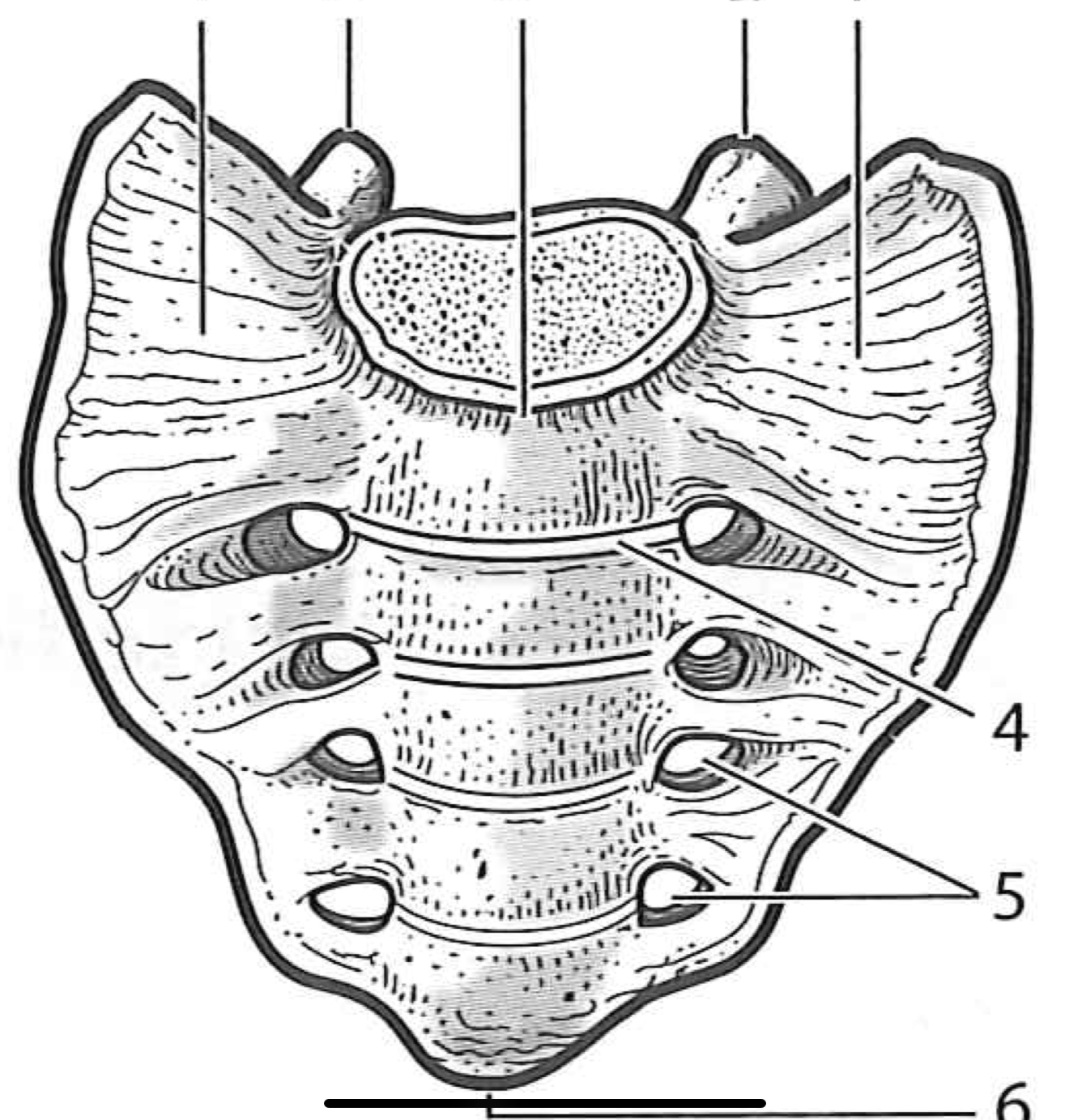 <p>Sacral vertebrae </p>