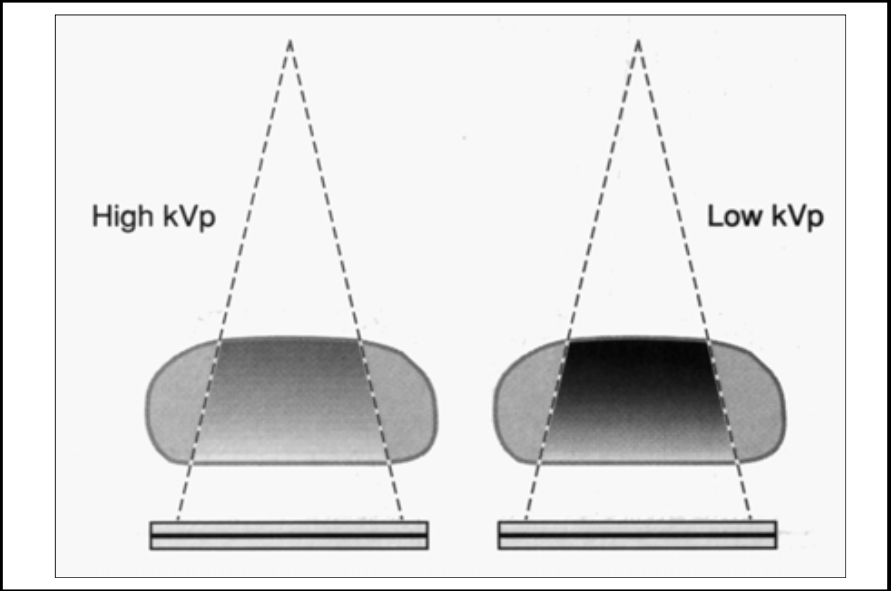 <p>To get through a thicker layer, you can either increase kVp or increase mAs. What is safer?</p><ul><li><p><span><strong>[...]</strong></span>&nbsp;</p></li></ul><p></p>