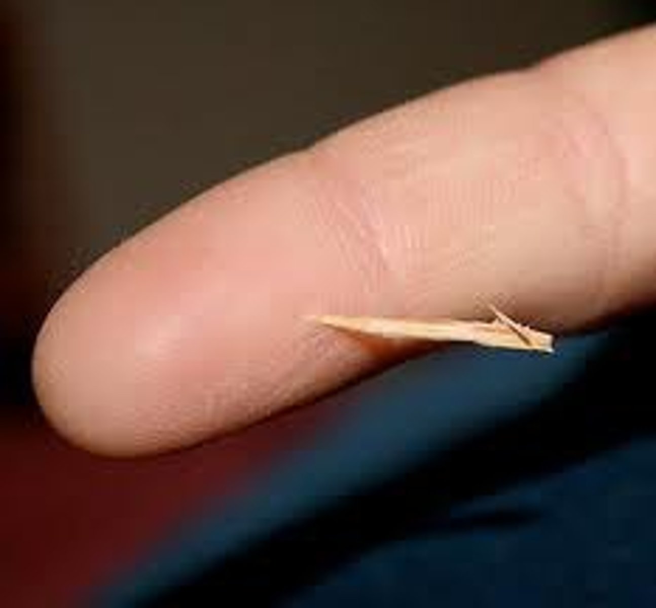 <p>Small sharp pieces of wood in your skin</p>
