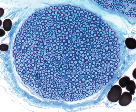 <p>Many individual neurons grouped in a single structure</p>