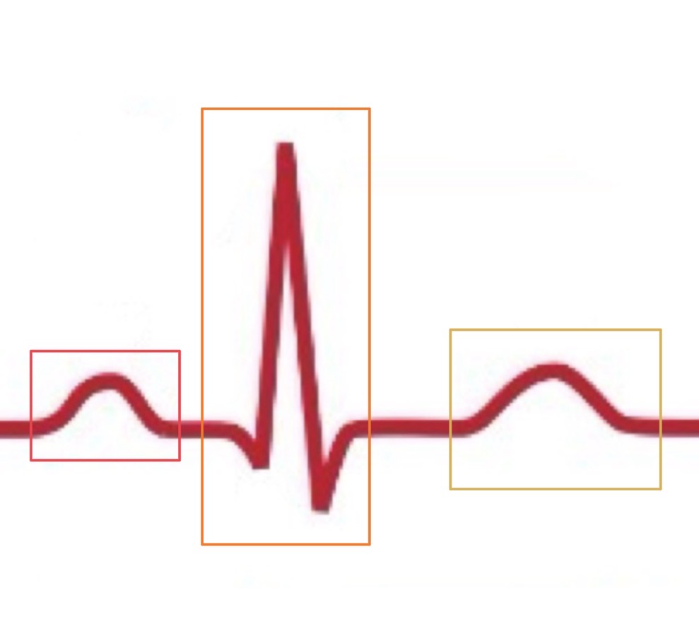 <p>What is electrically happening in the yellow box of the EKG graph?</p>