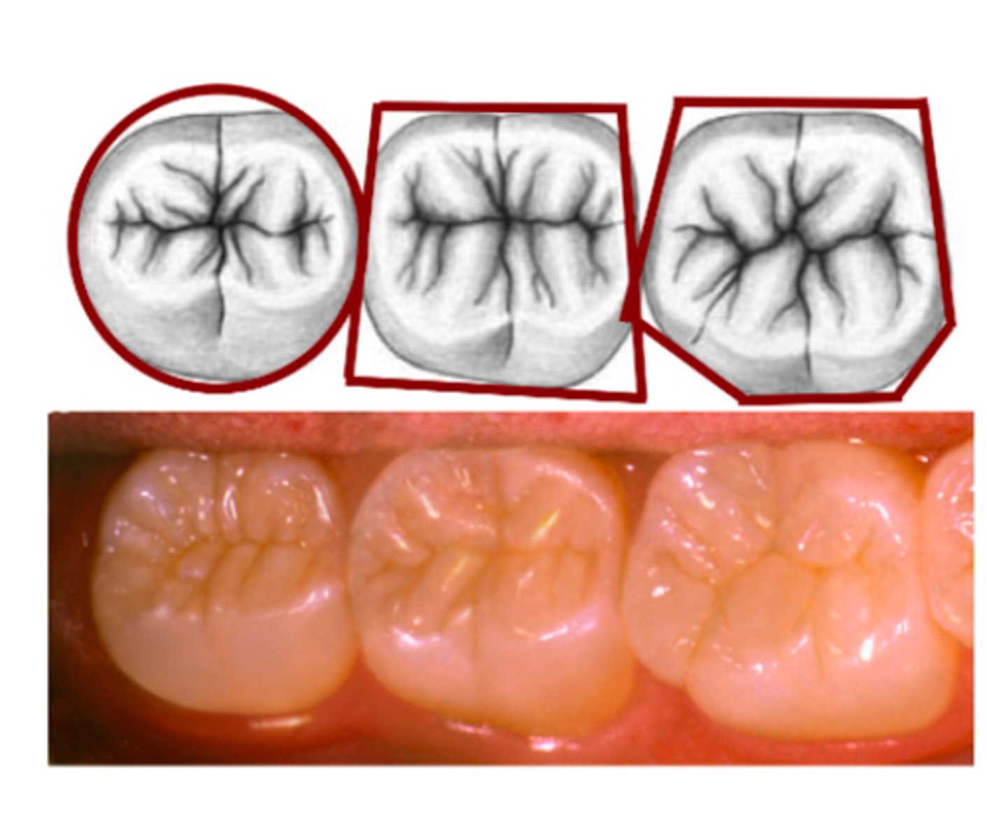 <p>Outer outline of the entire tooth crown from the occlusal view</p>