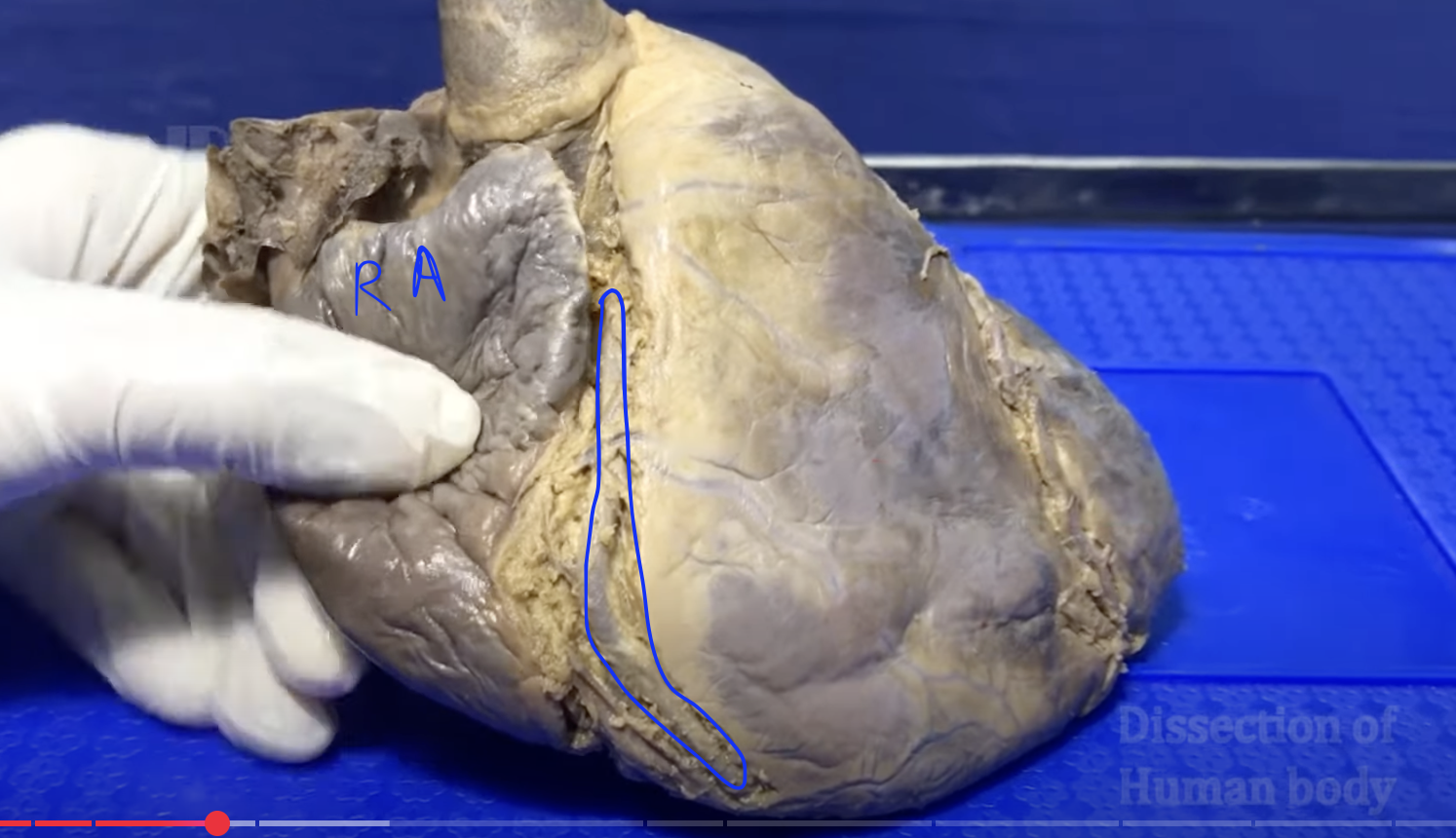 <p>name the circled artery</p>