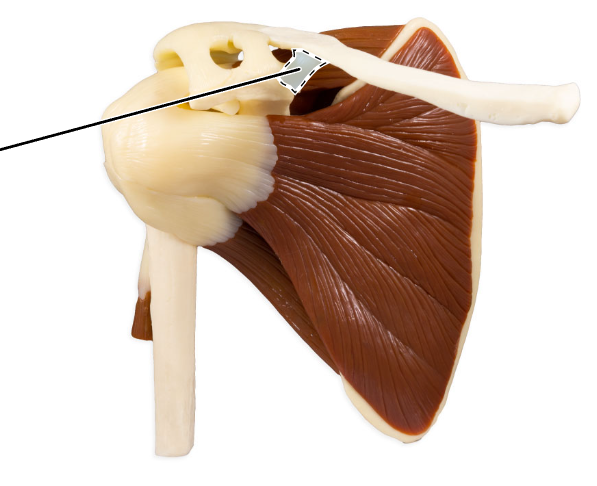 <p>What ligament is highlighted here?</p>