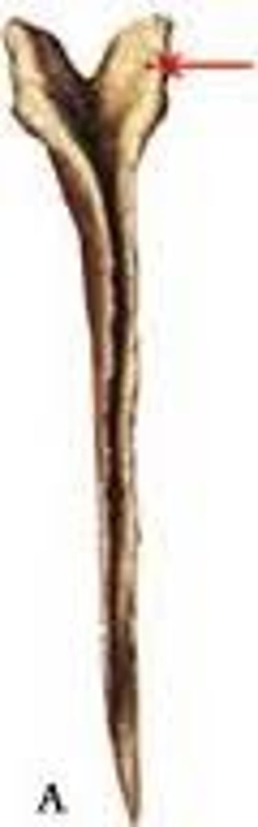 <p>what feature of vomer is this?</p>