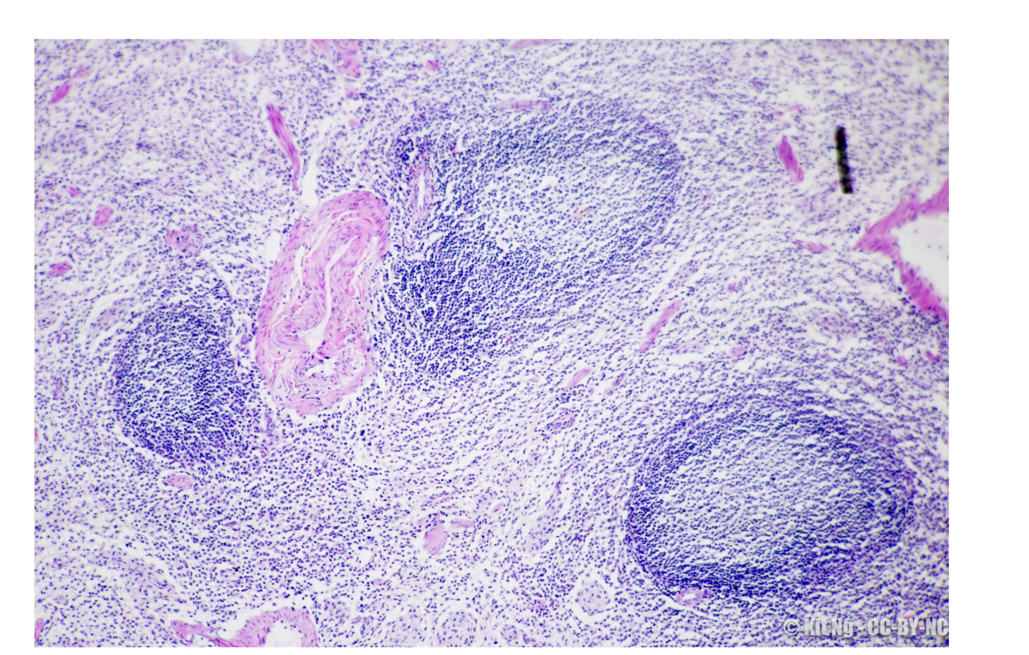 <p>what is the spleen? (functions + characteristics)</p>