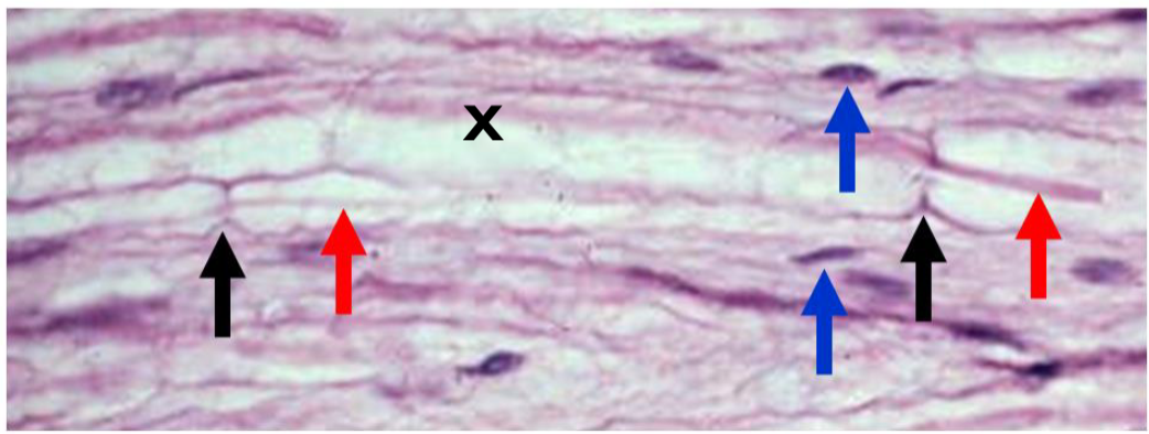 <p><span>Axons are eosinophilic (red arrows)</span></p><p><span>Schwann cell nuclei are basophilic (blue arrows)</span></p><p><span>Myelin is unstained (X)</span></p><p><span>Nodes of Ranvier (black arrows) are “pinches” along the axons </span></p>