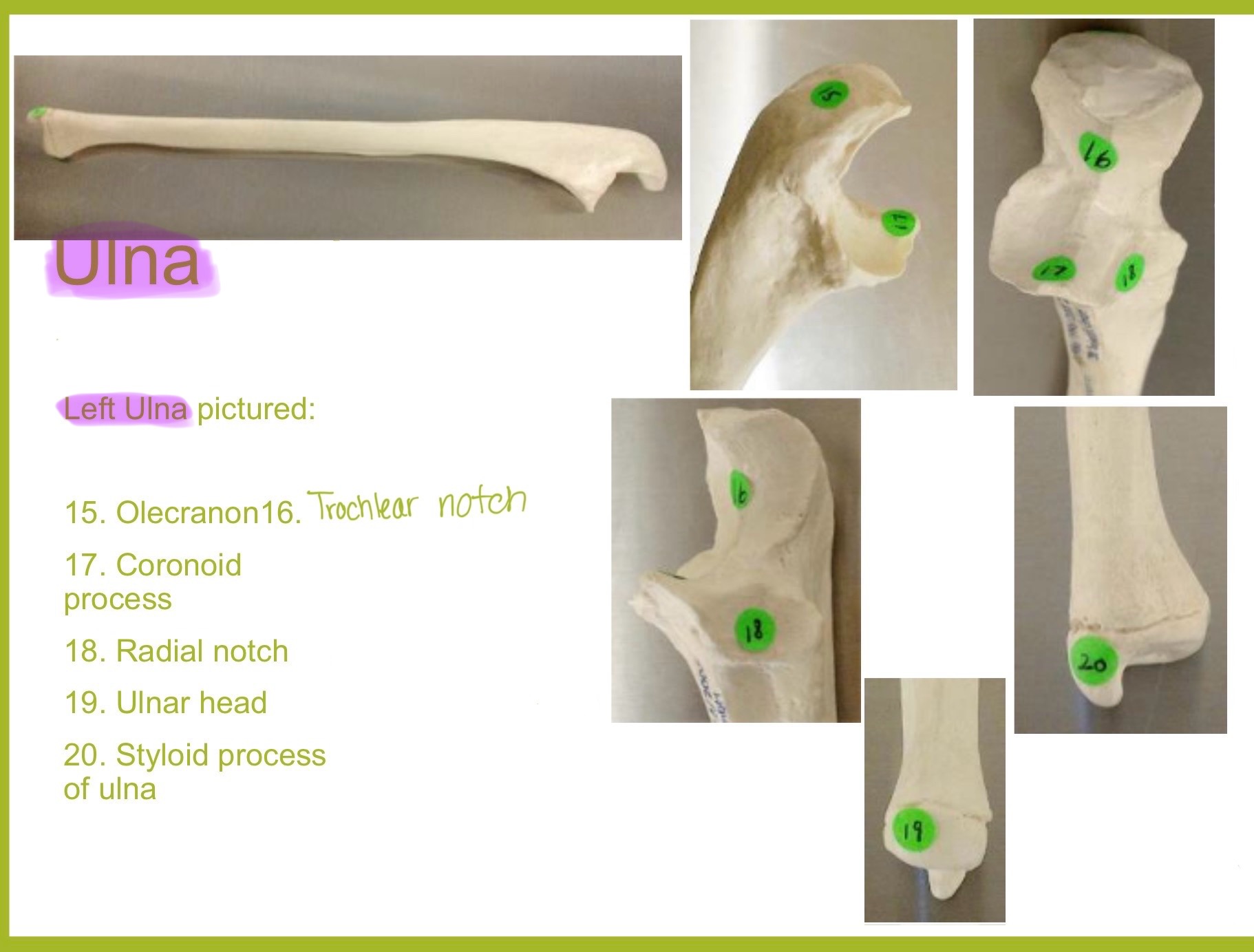 <p>ulna</p>