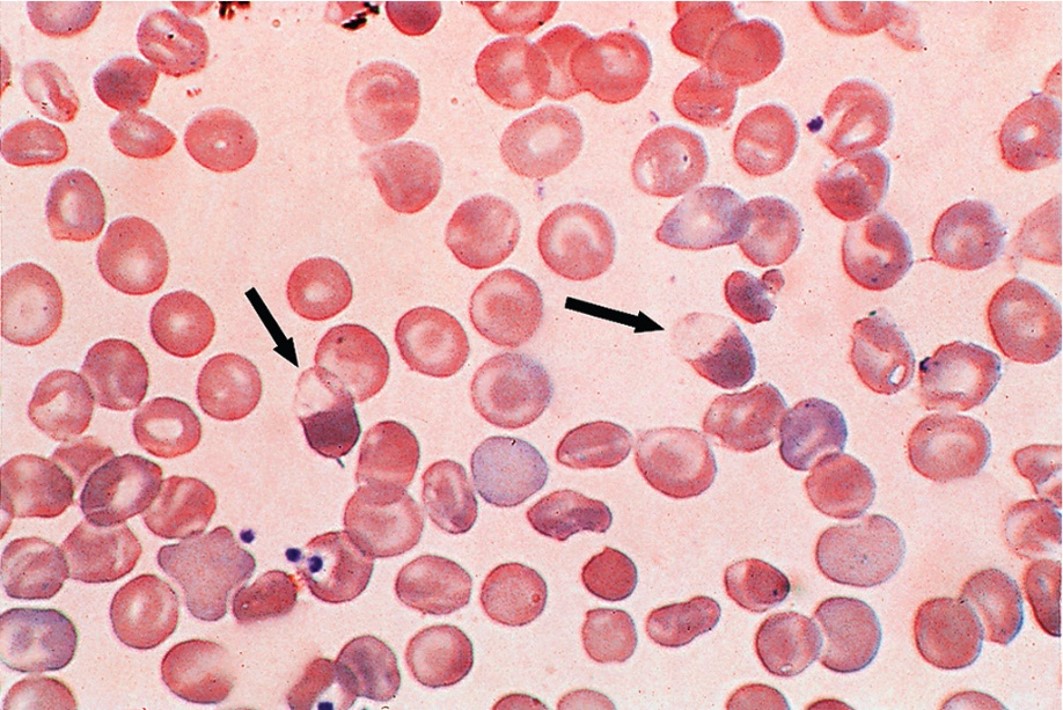 <p>What condition could possibly cause this?</p>