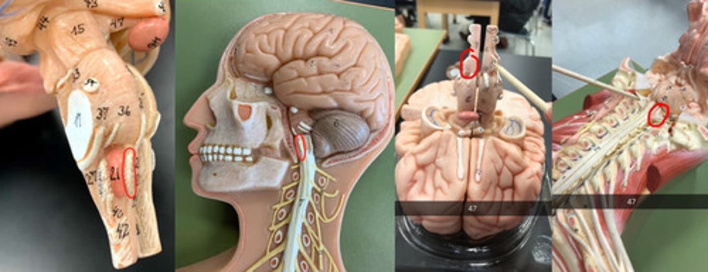 <p>Skull going through</p>