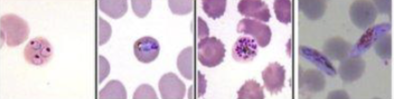 <p>What malaria parasite is this?</p>