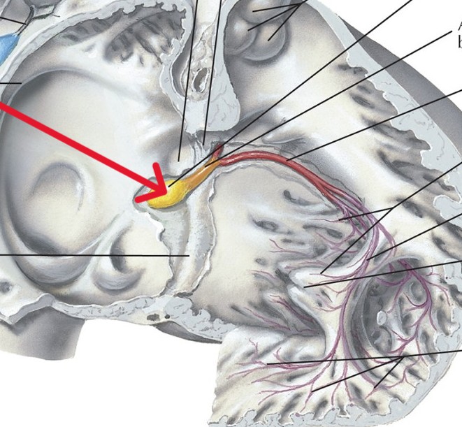 <p>Which part of the conduction system is this?</p>