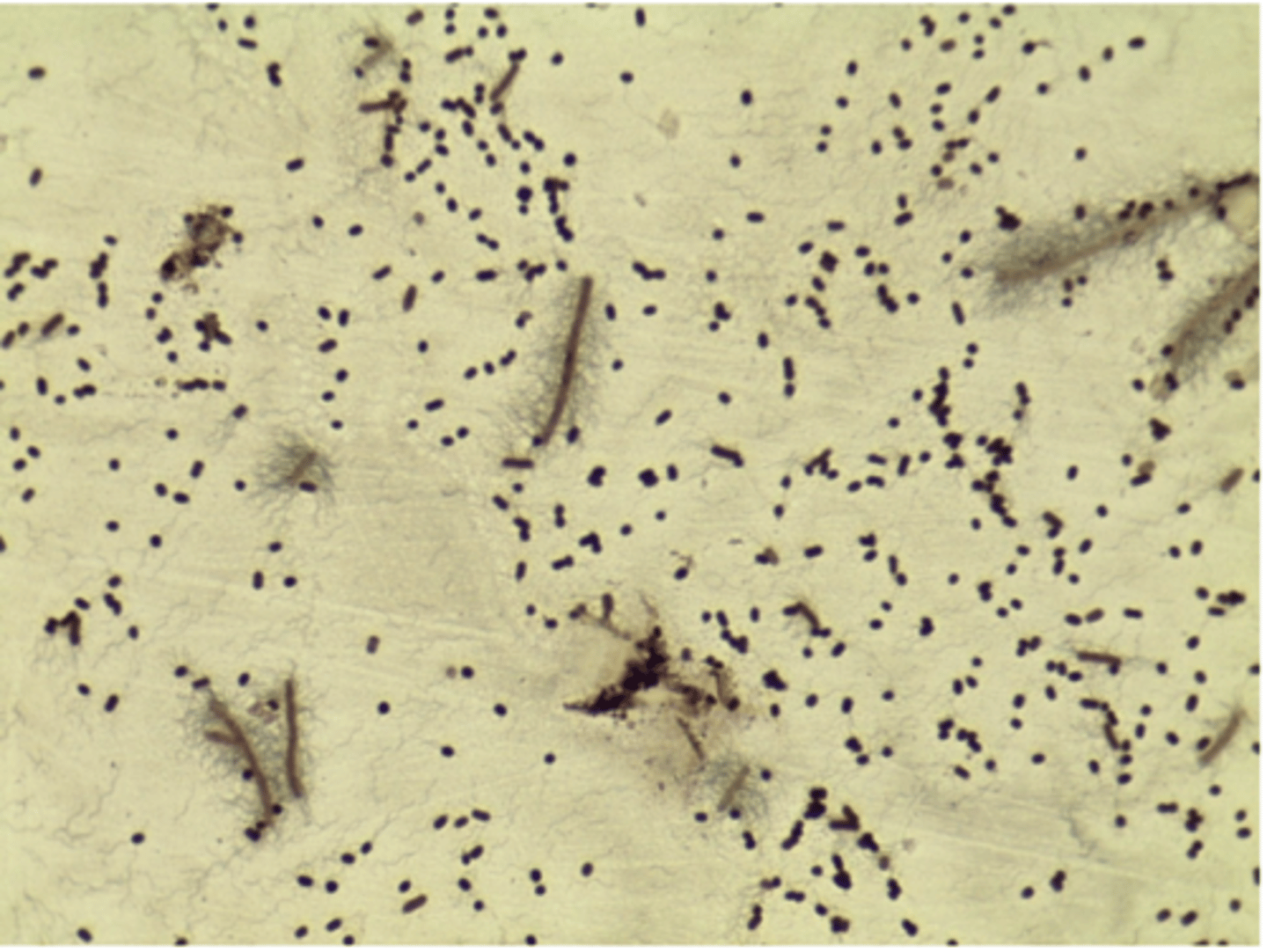 <p>- bacillus</p><p>EX: salmonella, proteus mirabilis</p>