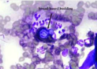 <p><span><span>Blastomycosis/Blasto</span></span></p>