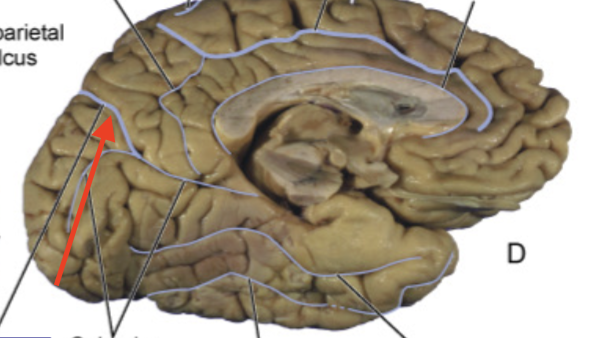 <p>separates parietal lobe from the occipital lobe</p>