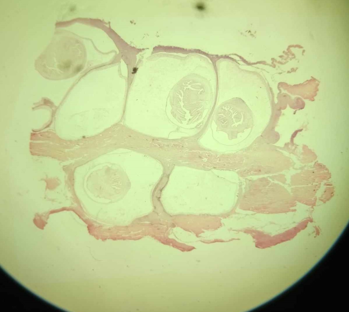 <p>name of larval stage and of which parasite? give the organ.</p>