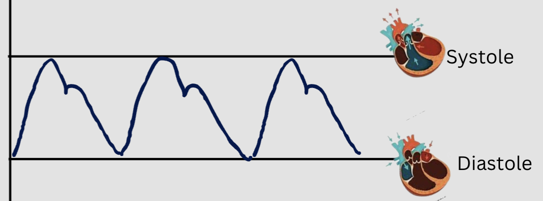 <p><span style="font-size: calc(var(--scale-factor)*19.99px)">pressure exerted against the walls of the arteries during diastole</span></p>