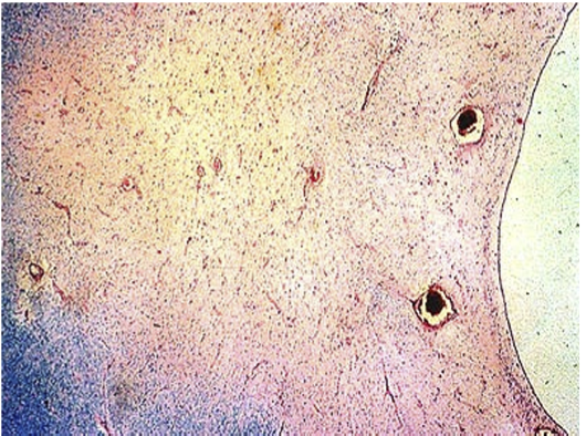 <p>What disease is this from </p>