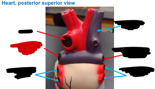 <p>Name this heart vessel</p>
