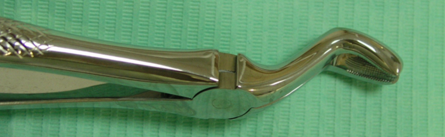 <p>Number of roots <strong>vary</strong>, fused</p><p>Distal- <strong>maxillary tuberosity</strong>- fragile, can fracture</p><p>1st luxation with elevator- rotational, force down and backwards&nbsp;</p><p>2nd luxation + traction with forceps- not fully open mouth&nbsp;</p>