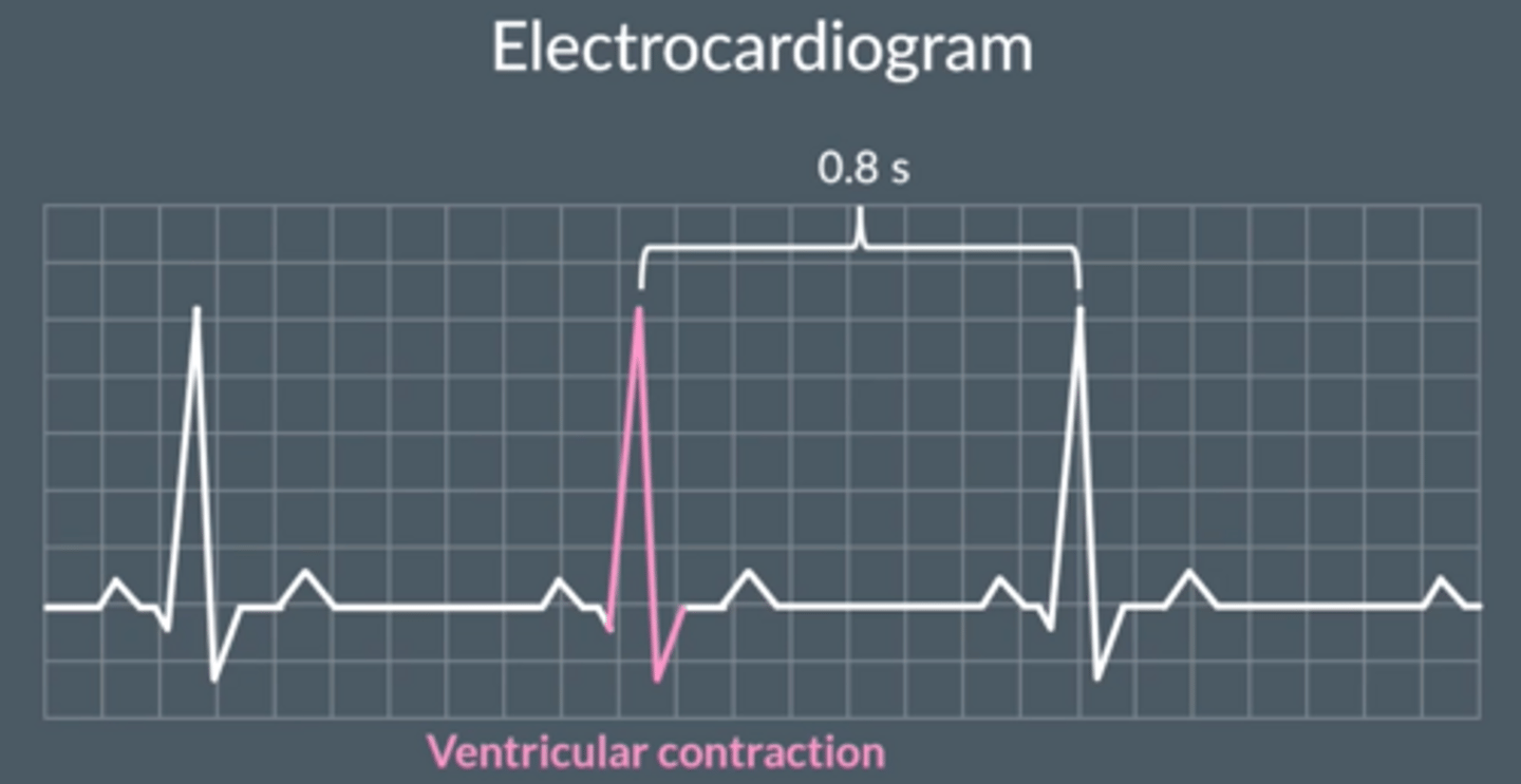<p>- Electrocardiogram, shows electrical activity of the heart.</p><p>- Each peak represents ventricular contraction</p><p>- Distance between peaks give time between heartbeats</p>
