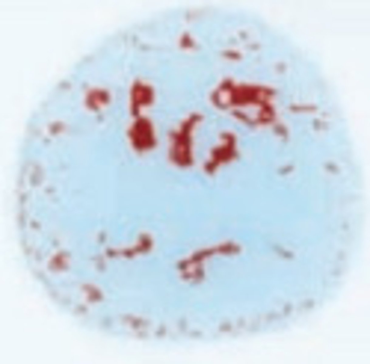 <p>When you add anti-serum A to Blood type AB you have agglutination.</p>