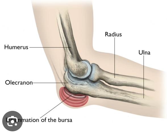 <p>point to elbow </p>