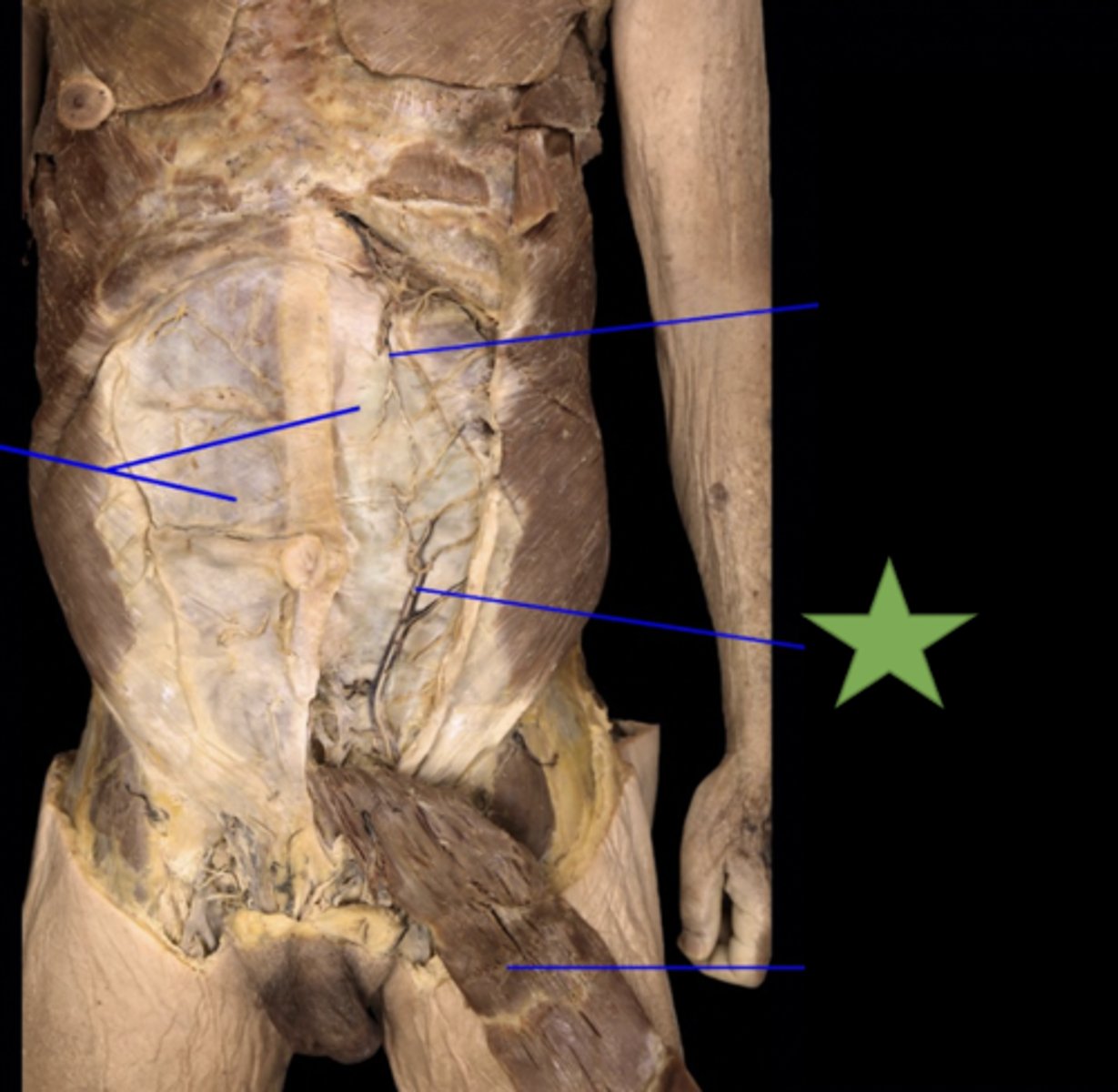 <p>artery</p>