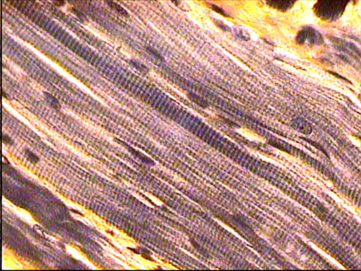 <p>cylindrical, elongated cells, multinucleated and striated (caused by filaments actin and myocin)</p><p>called muscle "fiber"</p><p>neurogenic-normally stimulated by nerve impulse</p><p>fastest response of musle types</p><p>make up skeletal muscles such as biceps brachii</p><p>function: provide voluntary contraction</p>