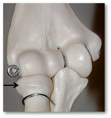 Name this specific part of the radius.