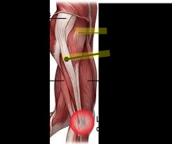 <p>What muscle is this?</p>