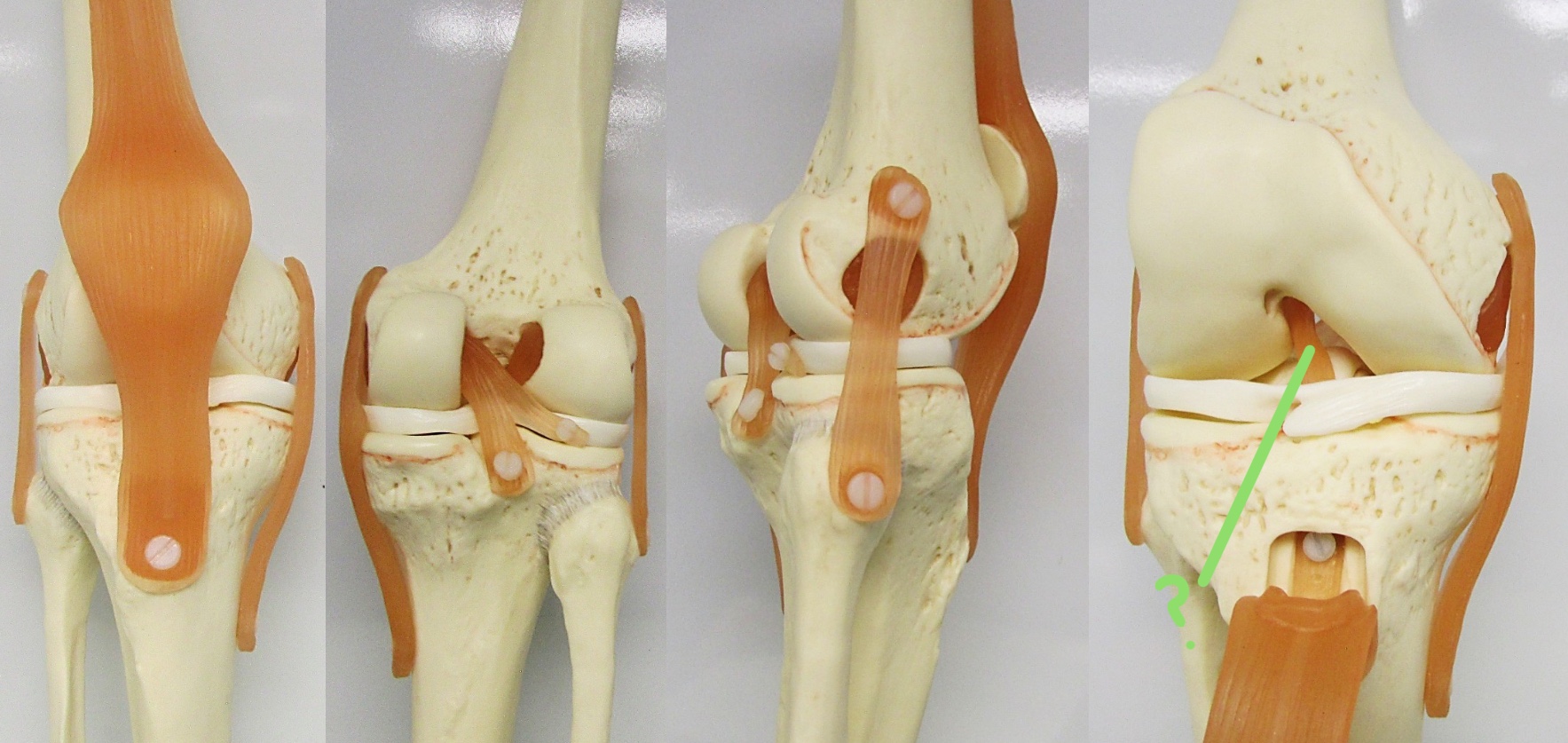 <p>Determine the part of the knee joint w/ ligament highlighted</p>