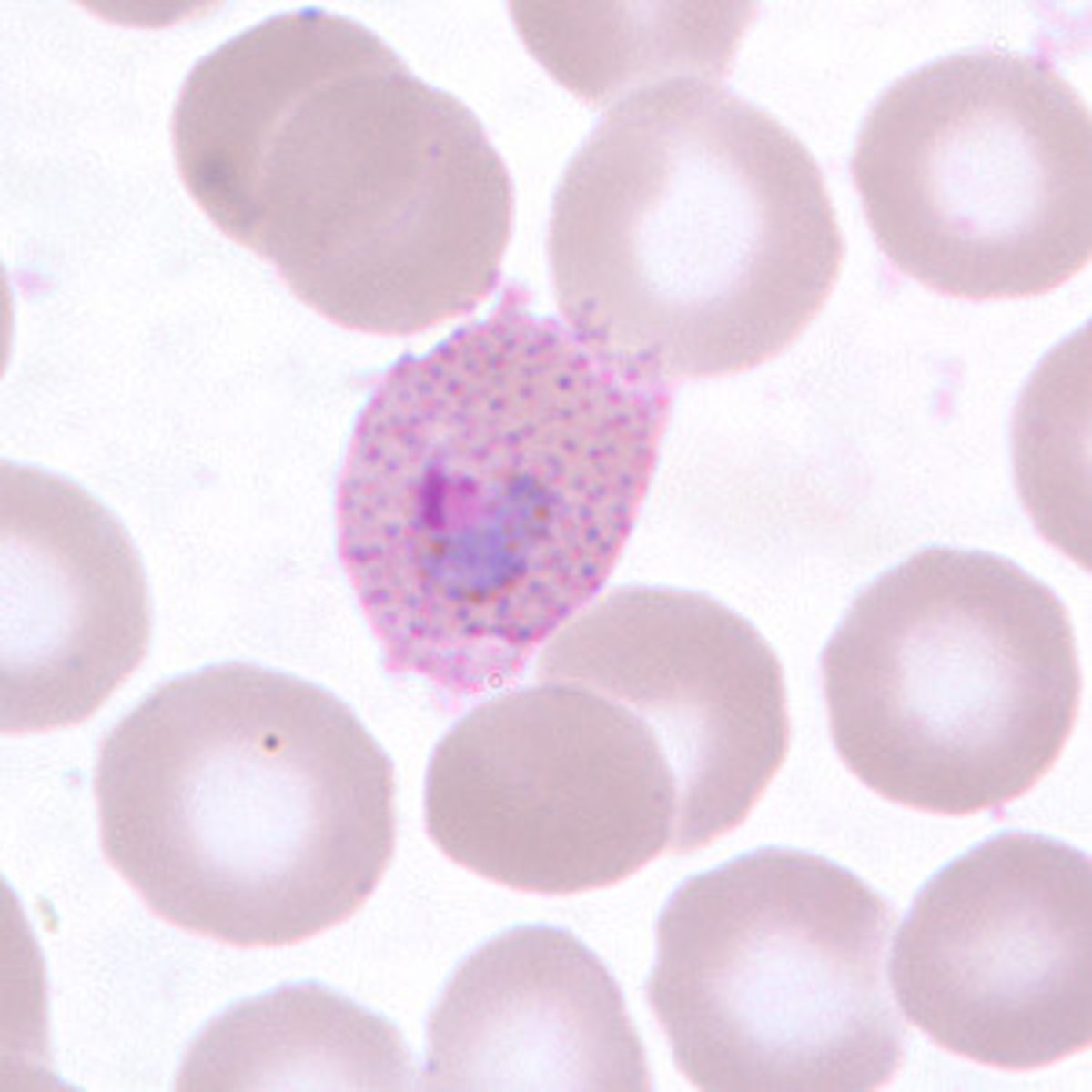 <p>oval RBC, Schuffner's dots</p>