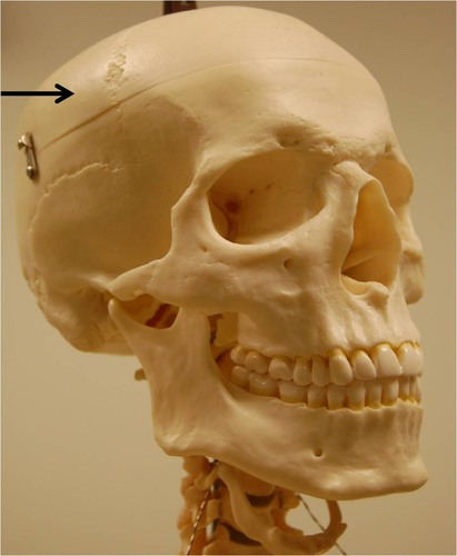 <p>Posterolateral to the frontal bone, forming sides of cranium</p>