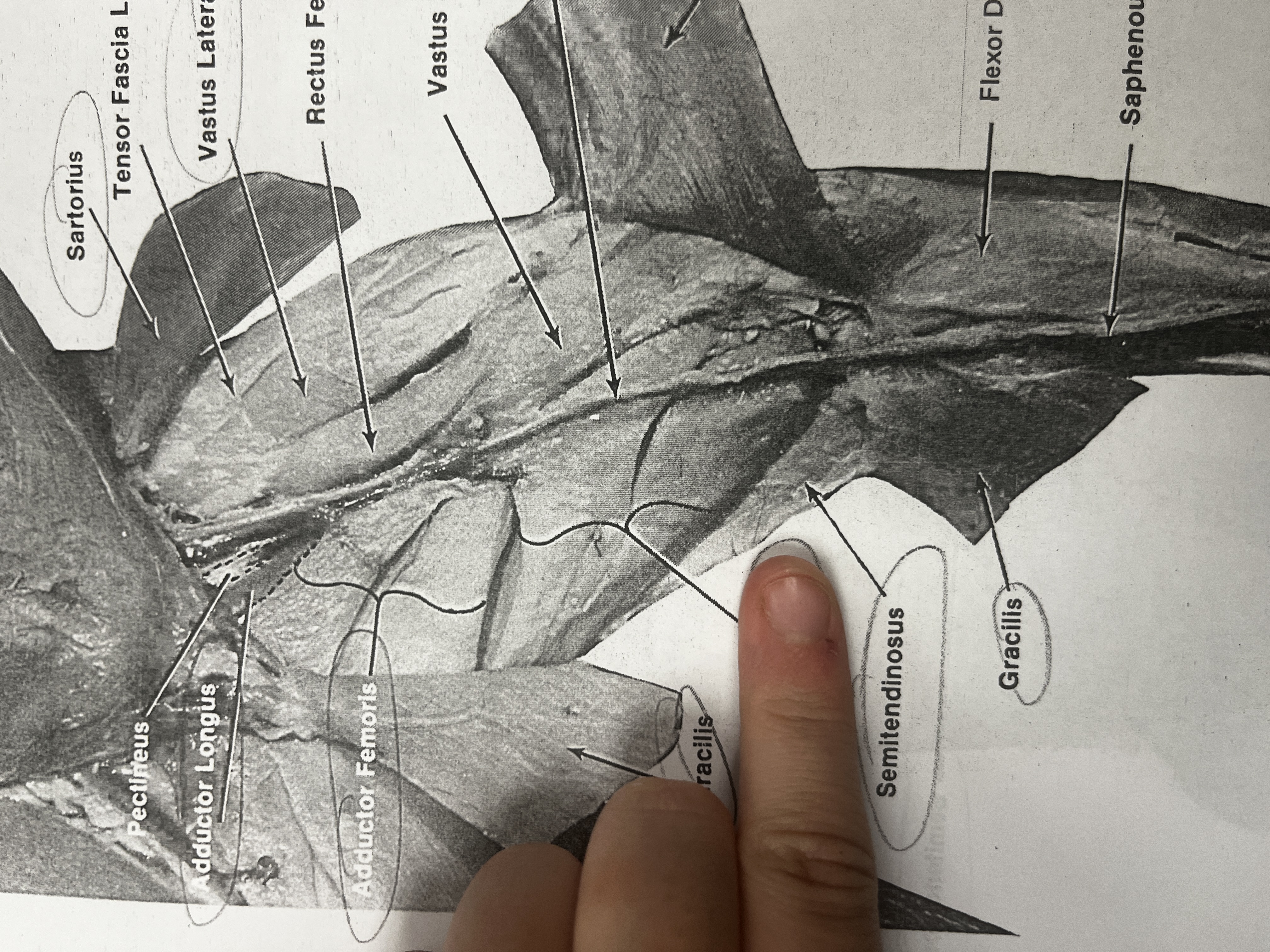 <p>A muscle of the hamstring group that helps in knee flexion.</p>