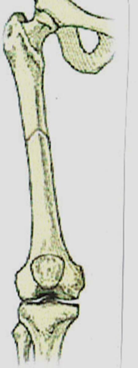 <p>Anatomic alignment of ends of fractured bone fragments, wherein the ends of the fragments make end-to-end contact</p>