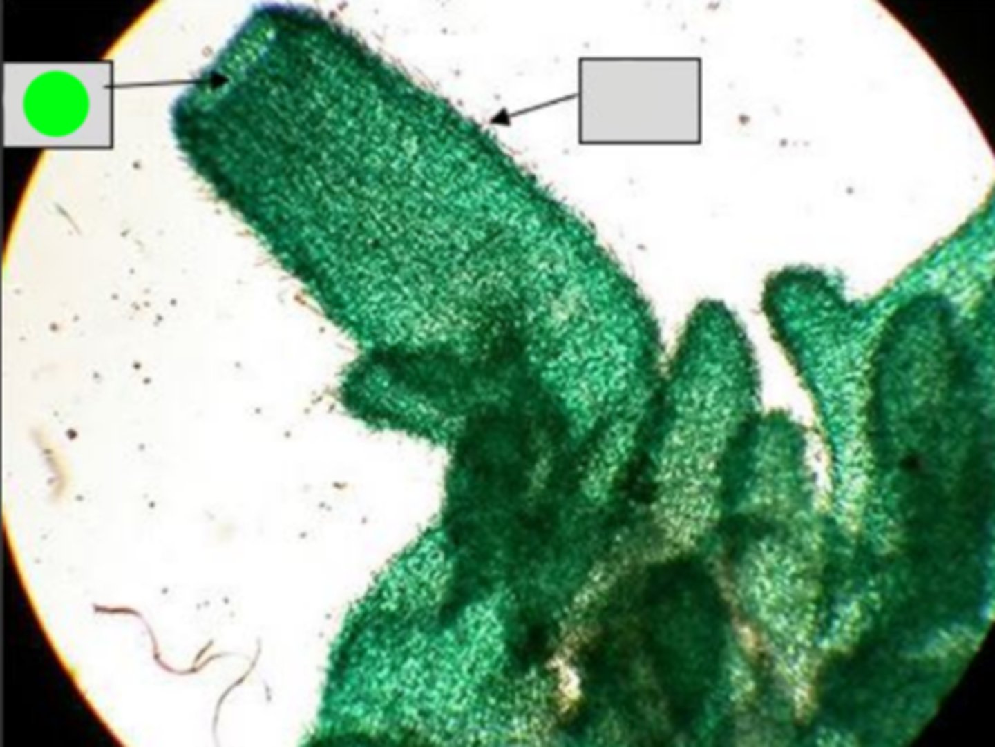 <p>Large opening in a sponge's body through which water exits after passing through the choanocyte-lined chambers and the spongocoel. It serves as the exit for water containing waste and carbon dioxide.</p>