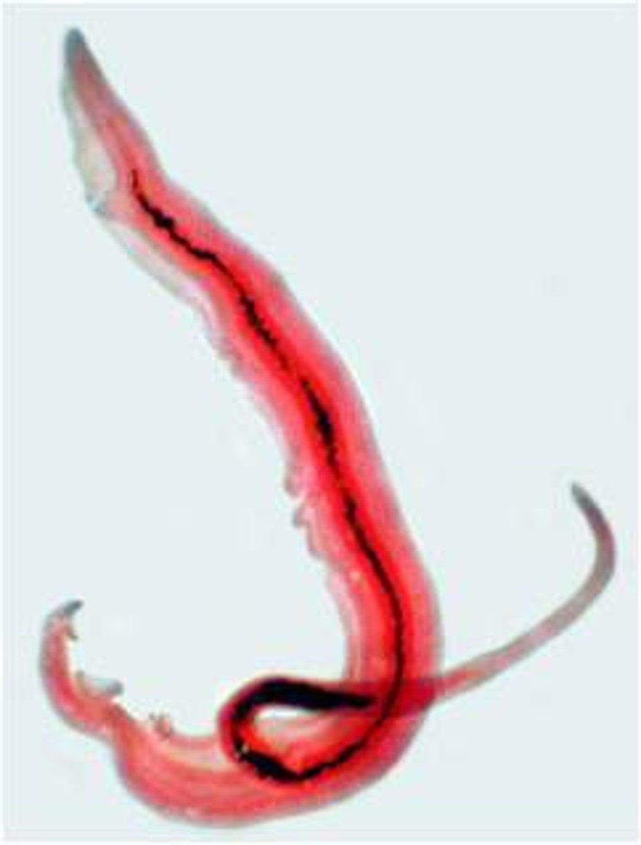 <p>Primarily defend against PARASITIC infections and are important in ALLERGIC responses - release interleukin, not histamine.</p><p>Normal % - 1-4%</p>