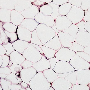 <p>Identify this connective tissue, its location, and its function.</p>