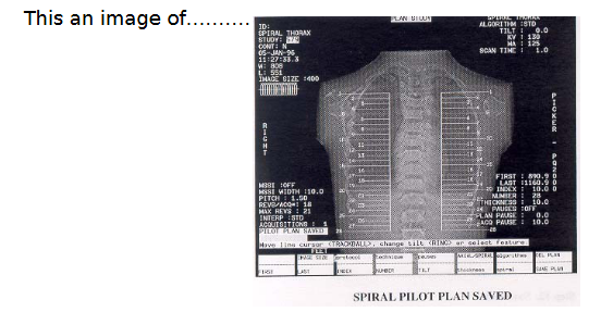 <p><span style="color: yellow"><strong>(EXAM): This is an image of ___</strong></span></p><p><span style="color: yellow"><strong>Give examples:</strong></span></p>