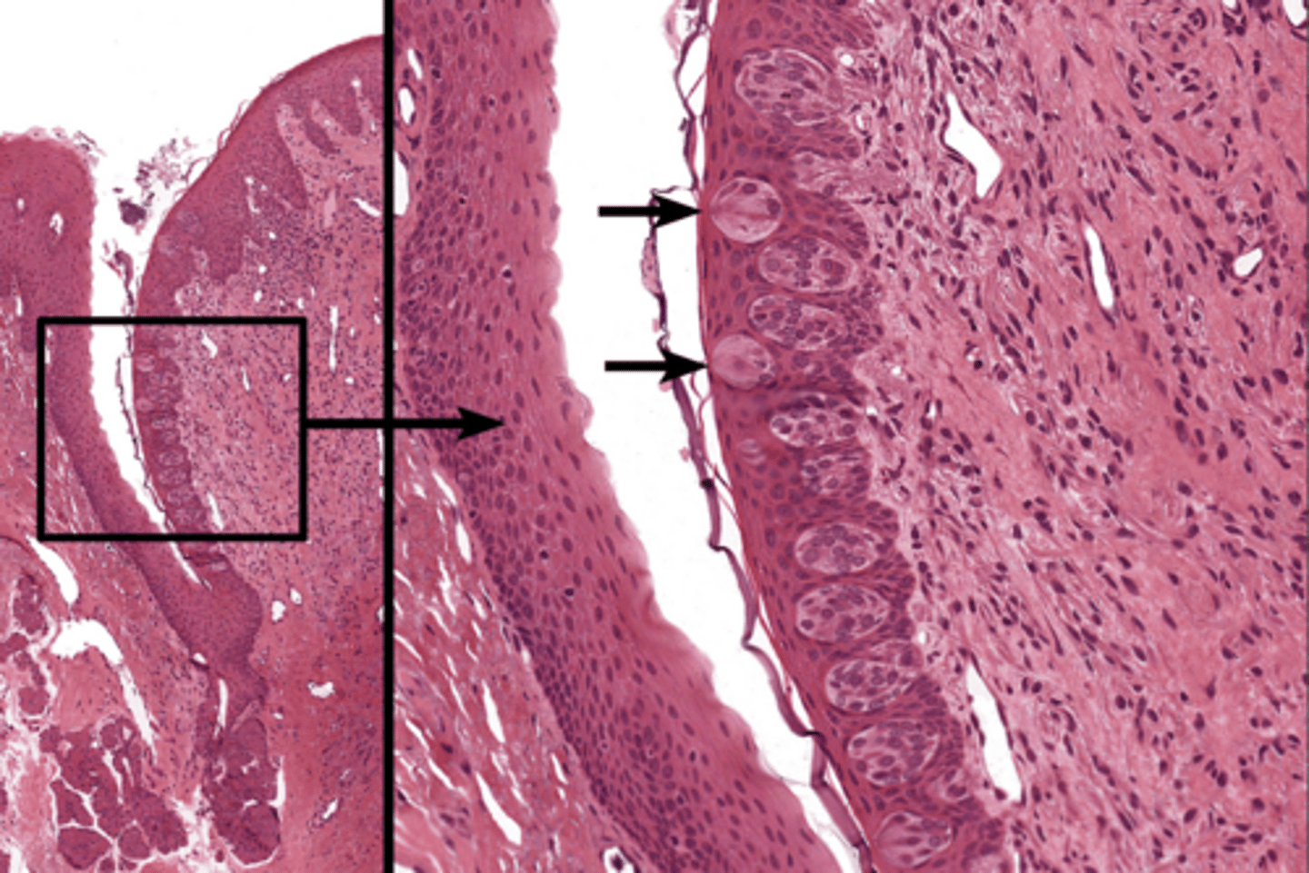 <p>very small openings in the top of the taste buds through which gustatory hairs project</p>