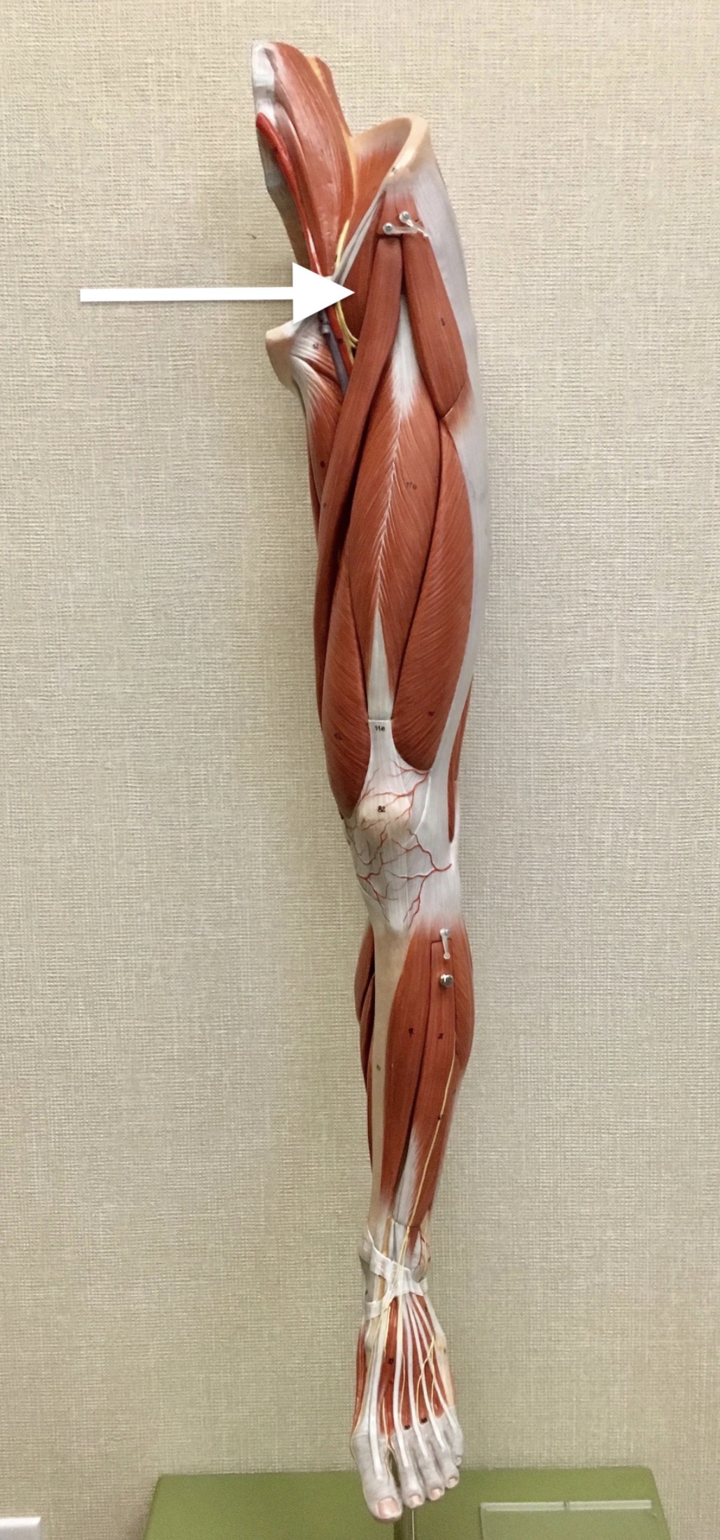 <p><span>Name the muscle labeled with the white arrow below:</span></p>