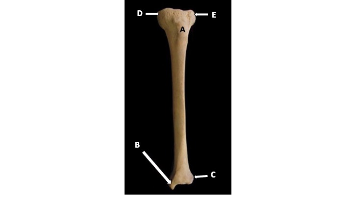 <p>What type of bone marking is D? (Hint: it’s inferior to the femur)</p>